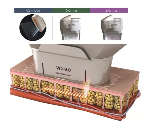 Classys Ultraformer III